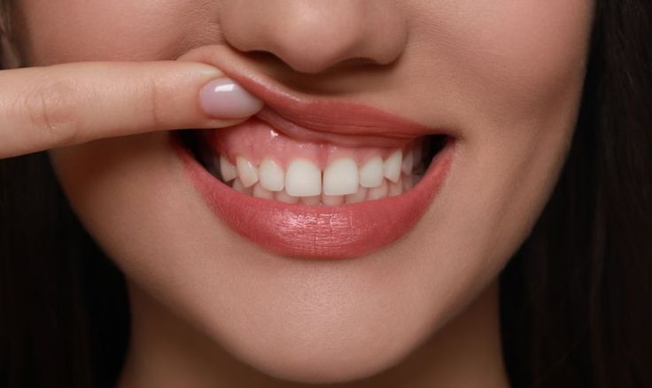 Gum Treatments Banner